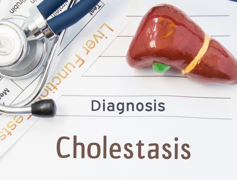 Epegörcs, eperoham, epekő, tünetei, oka, kezelése, gyógyszer