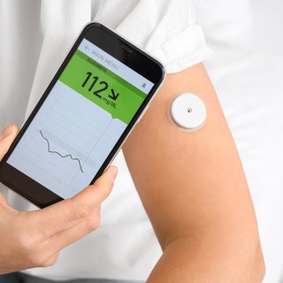 CGM : mit árulnak el a szöveti cukor monitorozással mért értékek? című cikk nyitóképe