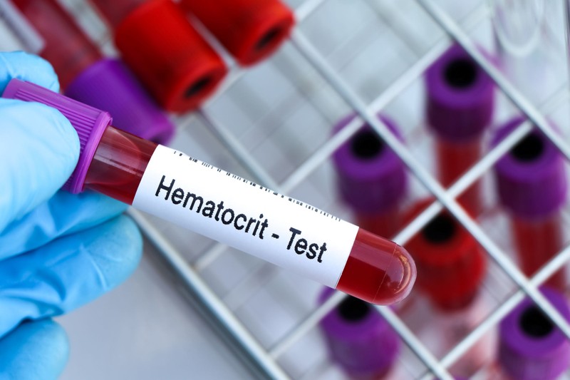 Hematokrit a vérképben: ezt jelenti, ha túl magas vagy túl alacsony az érték