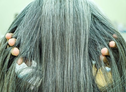 Meglepő felfedezés: az őszülés lehet a szervezet rákellenes védelmi reakciója című cikk nyitóképe