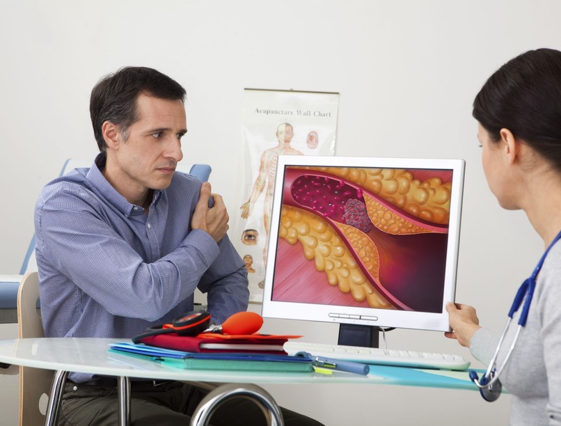 érelmeszesedés tünetei szűk artéria