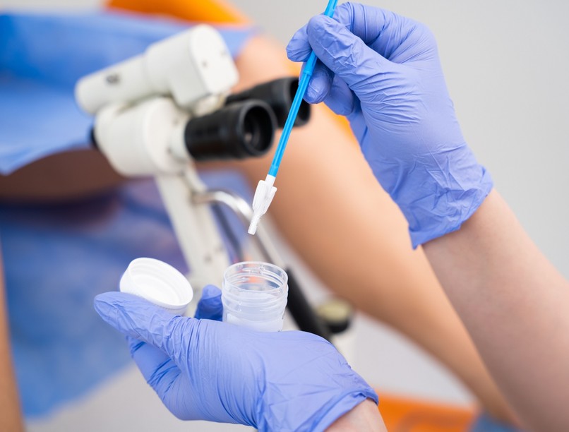 méhnyakrák szűrés milyen gyakran orvos válaszol