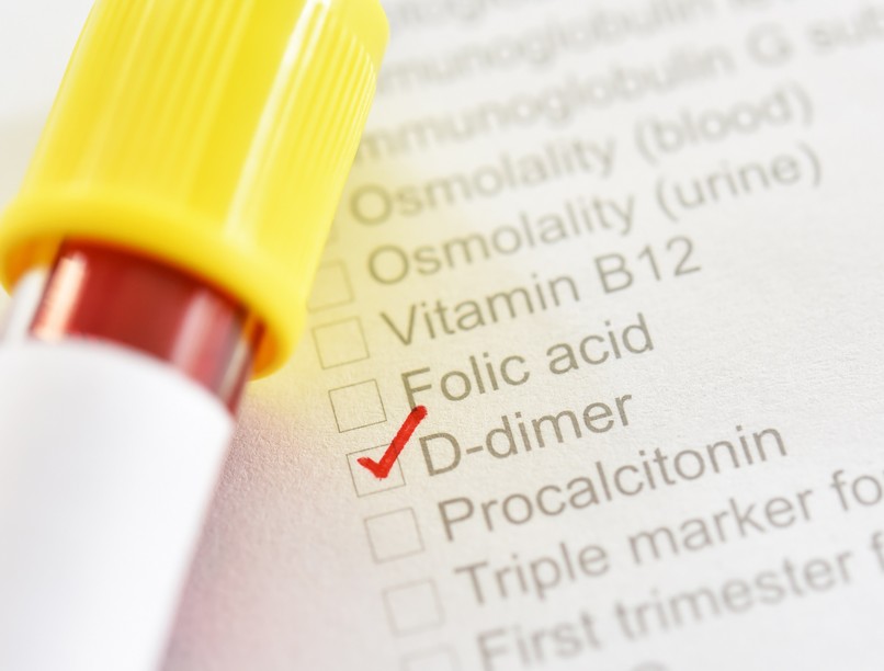 mit jelent a magas D-dimer érték laboreredmény