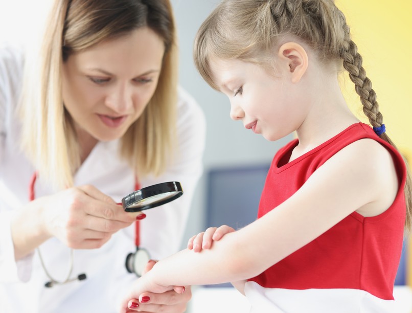 kanyaró járvány románia