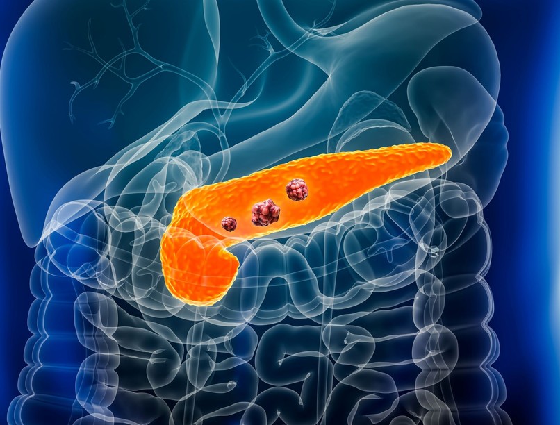 hasnyálmirigydaganat áttét immunterápia