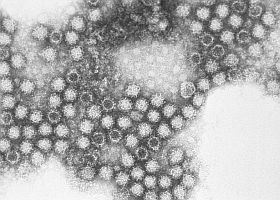 Gondolná, mi minden terjeszthet fertőzést?