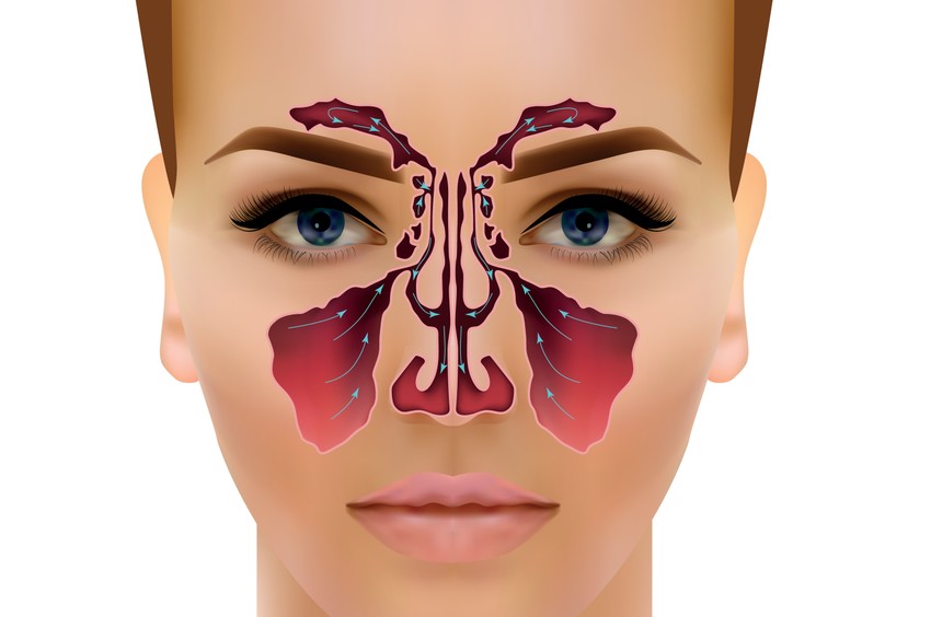Ha az orrvérzés nem szűnik, akkor mindenképp orvosi beavatkozásra van szükség, melynek mikéntje mindig a vérzés erősségétől és helyétől függ.