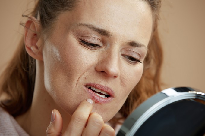 Mi jó herpesz ellen? Ezeket a gyógynövényekkel hívhatja segítségül című cikk nyitóképe