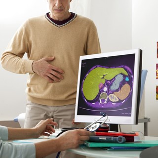 Ezért jelent olyan nagy kihívást a szervezetnek a lép gyógyulása című cikk nyitóképe