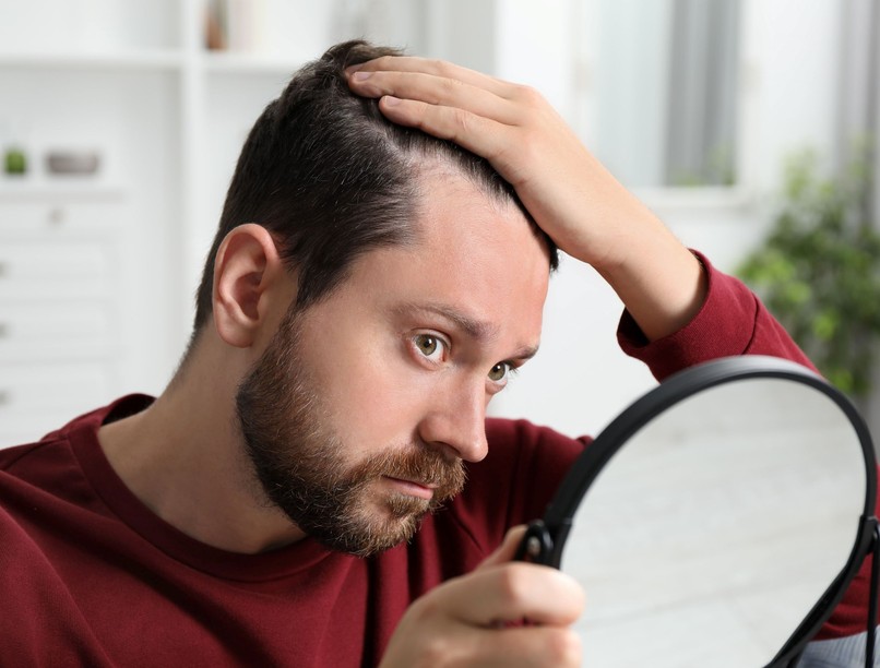 melanóma hajas fejbőr anyajegy