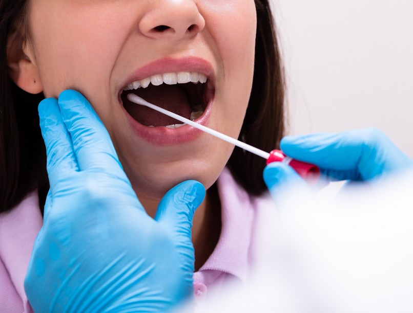 keserű, savanyú ízű nyál jele tünete nyálteszt