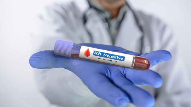 Miért ritka az Rh-negatív vércsoport?