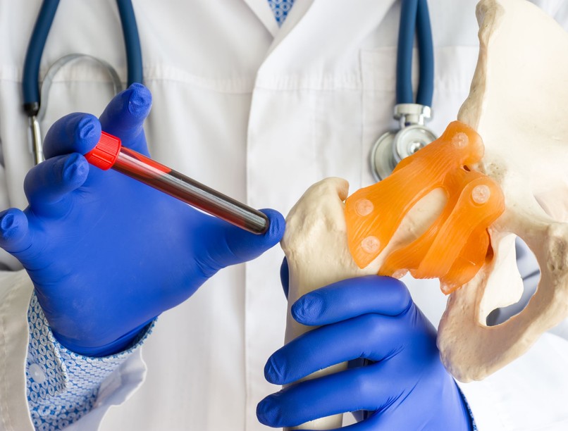 rosszindulatú csontrák korai jele Ewing-szarkóma tünete