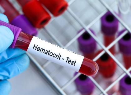 Hematokrit a vérképben: ezt jelenti, ha túl magas vagy túl alacsony az érték című cikk nyitóképe