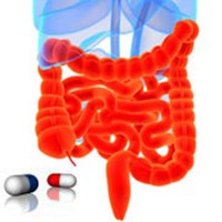 Csökkenti a vastagbélrák kockázatát a D-vitamin