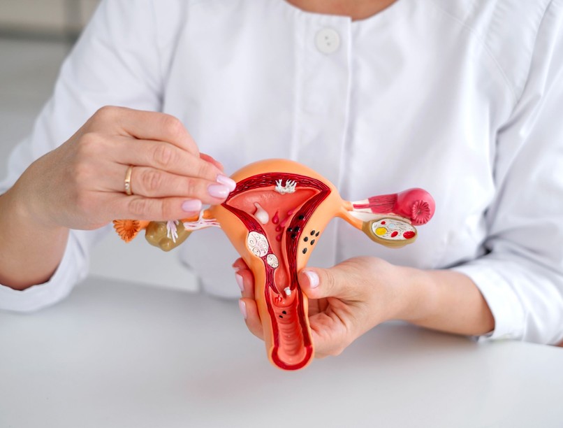 daganatok mióma ártalmatlan veszélyes