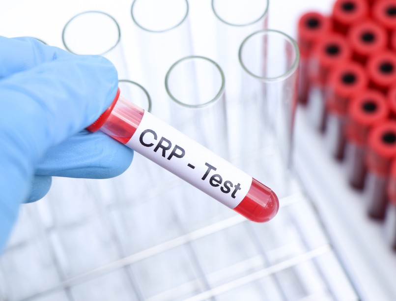 mit jelent a magas CRP érték lelet betegség oka