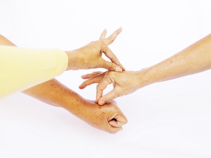 Csipkedje meg a kezén a bőrt, és megtudja, elég vizet ivott-e, vagy már dehidratált című cikk nyitóképe