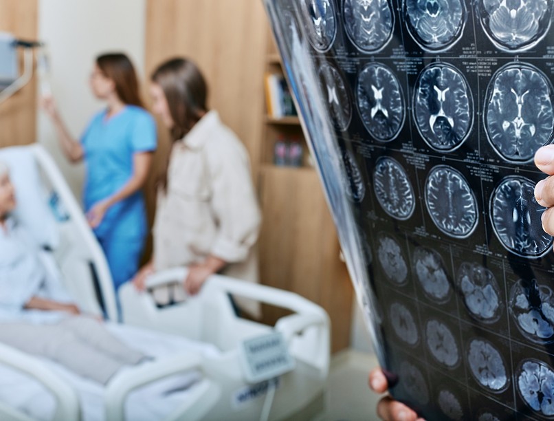 stroke tünet sztrók utáni maradványtünet izombénulás 