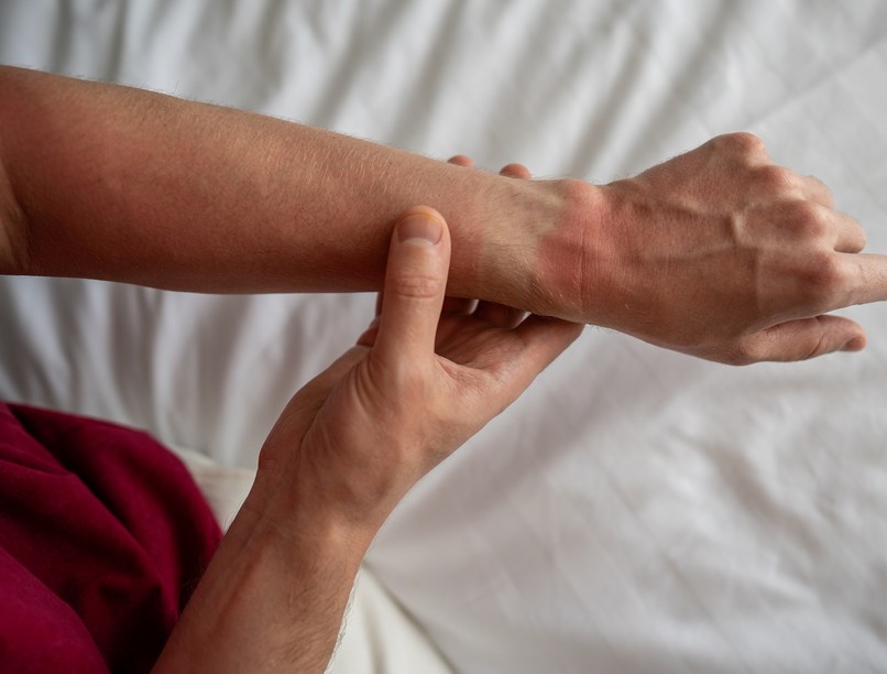 napallergia kezelése