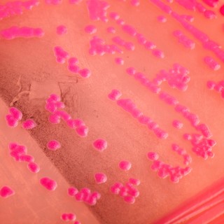 Mi a mikrobiológiai tenyésztés és mit mutat ki? című cikk nyitóképe