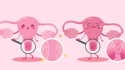 Petefészek elégtelenség: tünetei, vizsgálata és kezelési lehetőségei című cikk nyitóképe