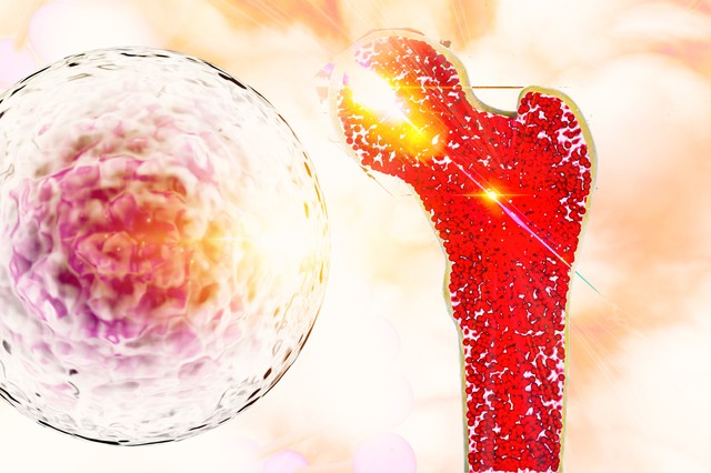 Rosszindulatú csontdaganat fiatal korban? Ezek a figyelmeztető jelek