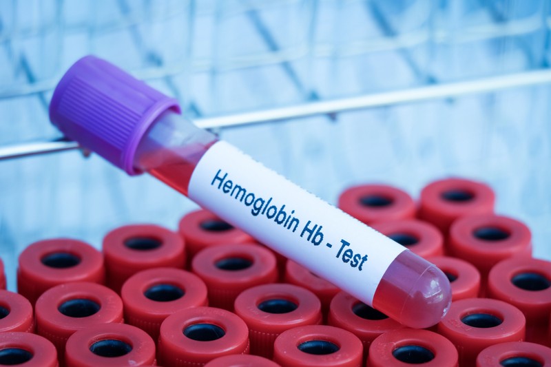 Alacsony hemoglobinszint  - ebben az esetben már igen veszélyes