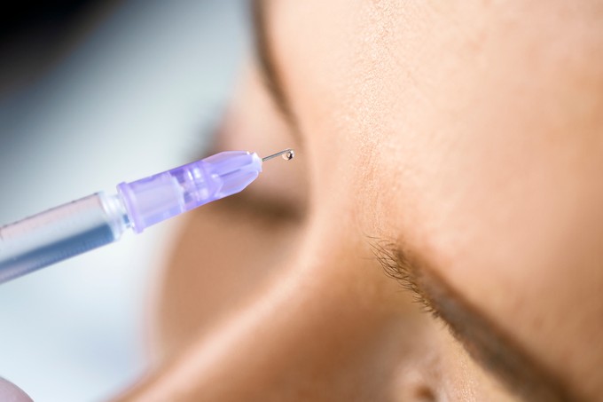 Miben segíthet a Botox-terápia? Fogcsikorgatástól az arcidegzsábáig című cikk nyitóképe