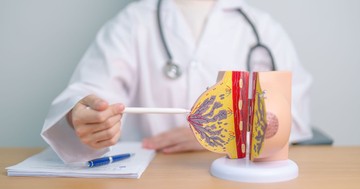  Emlőeltávolítás: nem csak daganat esetén kerülhet rá sor - ilyenkor szükséges a műtét 