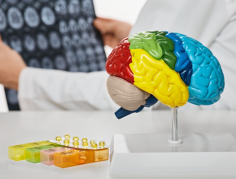 stroke agyvérzés gutaütés D vitamin vitaminhiány