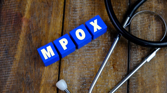 Két kutatót őrizetbe vettek, mert megpróbáltak Afrikából mpox- vírust bejuttatni az USA-ba