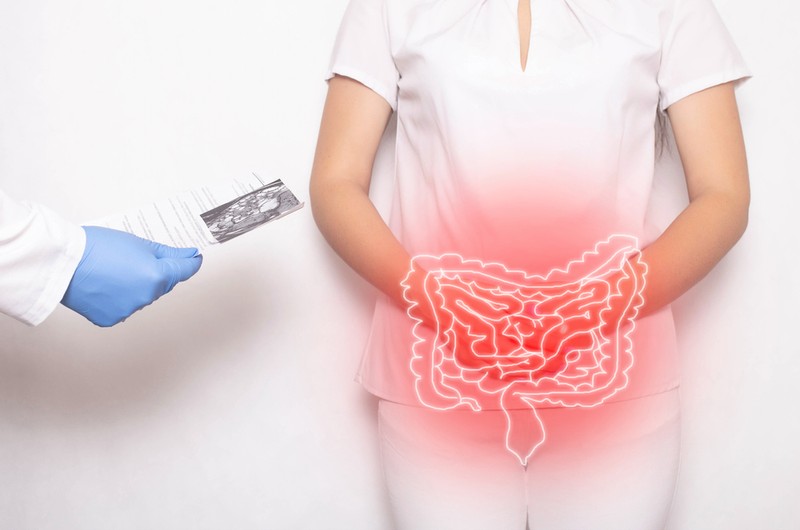 A Crohn-betegség oka, tünetei és kezelési lehetőségei