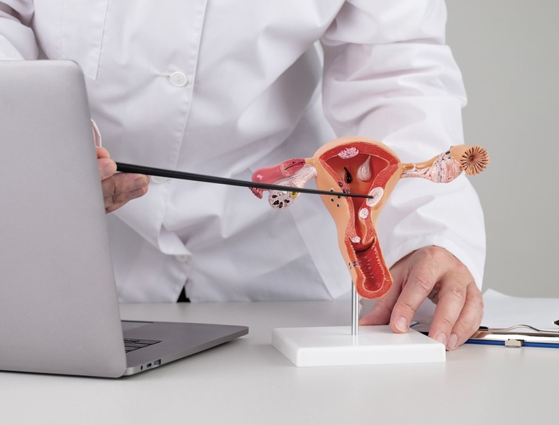 endometriózis, gócok, gyulladás, diagnózis, antitest, gyógyítás, kutatás,