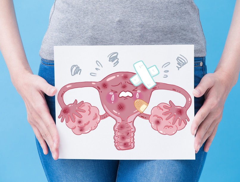 petefészek rák daganat tünet jel puffadás oka