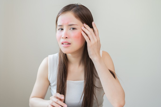 Miért pirulunk el, amikor idegesek vagyunk? című cikk nyitóképe