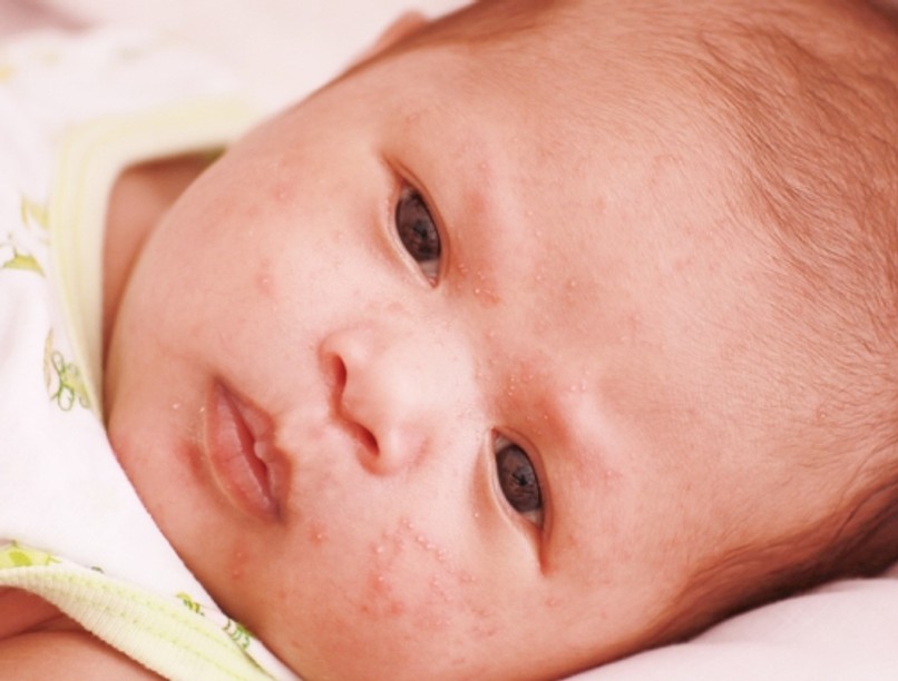 kanyaro_veszelyeztetettek_0