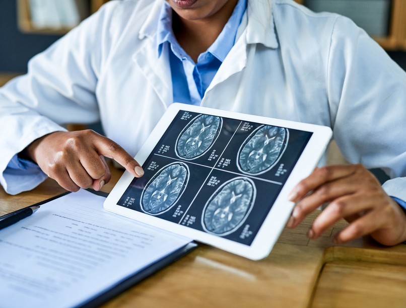 daganat, kezelés, rákmentes, rák, agydaganat, immunterápia