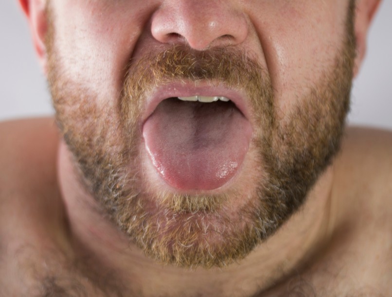 nyelv égő érzés, fájdalom, oka pajzsmirigy