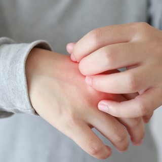 Miért viszket a bőröm télen? Ez áll a kellemetlen panasz hátterében című cikk nyitóképe