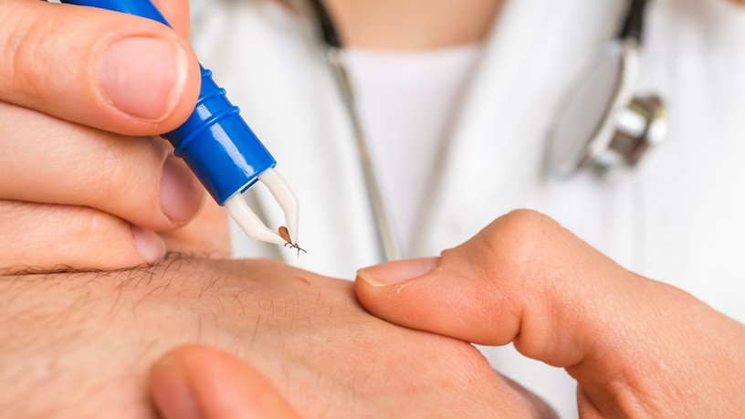lyme-kór kullancs videó Országos Mentőszolgálat