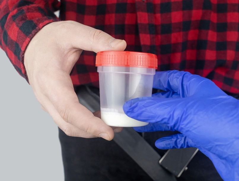 gyakori ejakuláció spermakép spermium kutatás