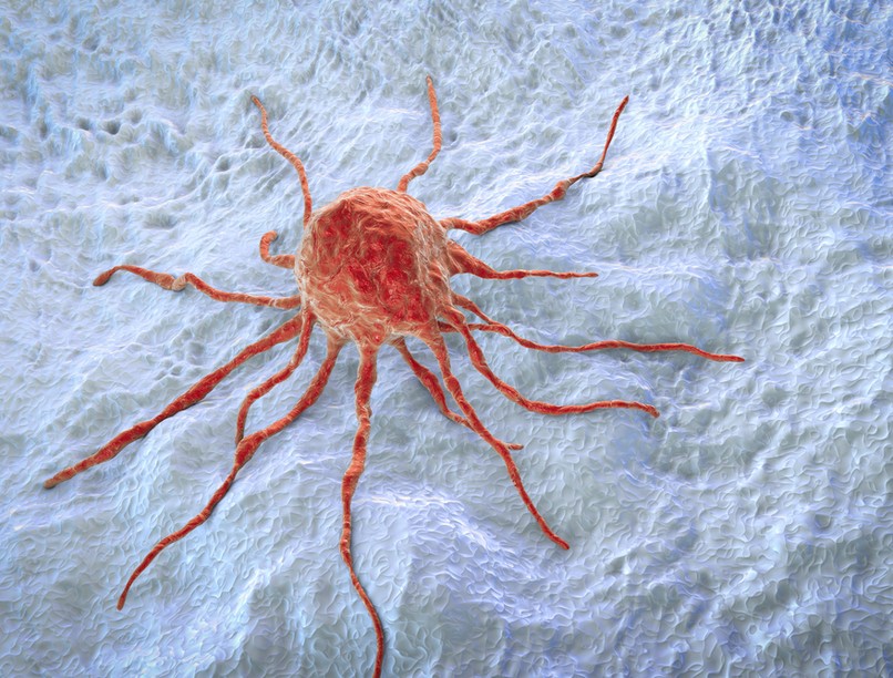 tévhitek a rákról, daganat, HPV fertőzés, emlőrák