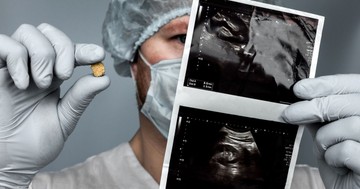  Mitől alakul ki a vesekő? Ez az, amit a háttérben zajló folyamatokról tudnia érdemes 