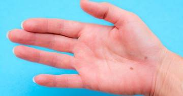 Mit jelent az anyajegy a tenyéren vagy a kézen? Kevesen tudják, hogy a jellemünk is kiolvasható belőle