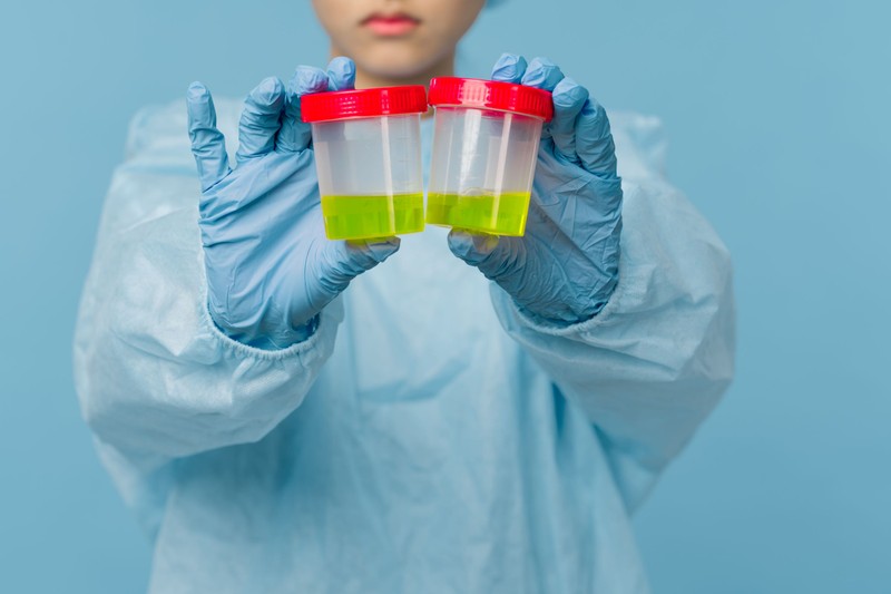 Ezek a vitaminok megváltoztatják a vizelet színét - ne aggódjon miatta!