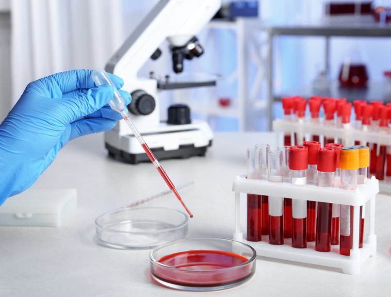 vérkép, labor, lelet, vizsgálat