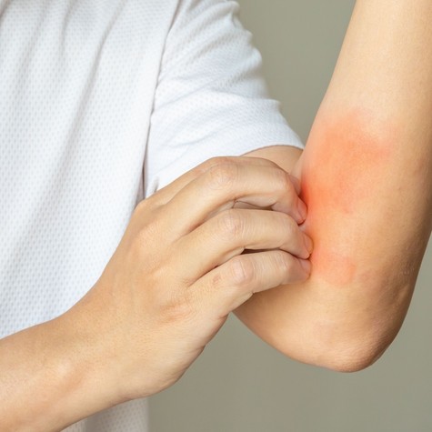 Célkeresztben a táplálékintolerancia-tesztek: vizsgálatot kezdeményezett az ügyészség című cikk nyitóképe