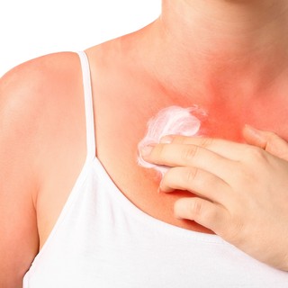 Napallergia kezelése házilag című cikk nyitóképe