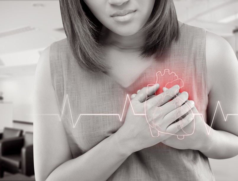 szívinfarktus, szívroham, infarktus, szívroham tünetei